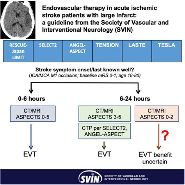 2018 Guidelines for Acute Ischemic Stroke Management: Essential PDF PDF