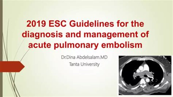 2019 ESC Guidelines for Pulmonary Embolism Diagnosis and Management – PDF
