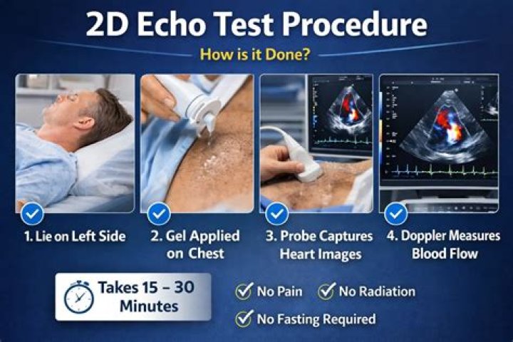 How to Perform a 2D Echo Test PDF Guide