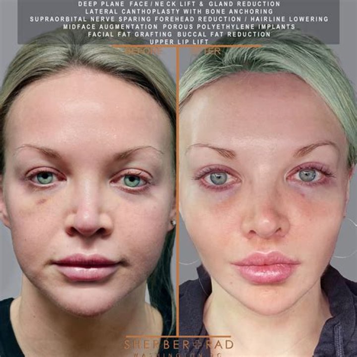 Botched Botox Party in the Hamptons: Shocking Answer Key PDF Revealed