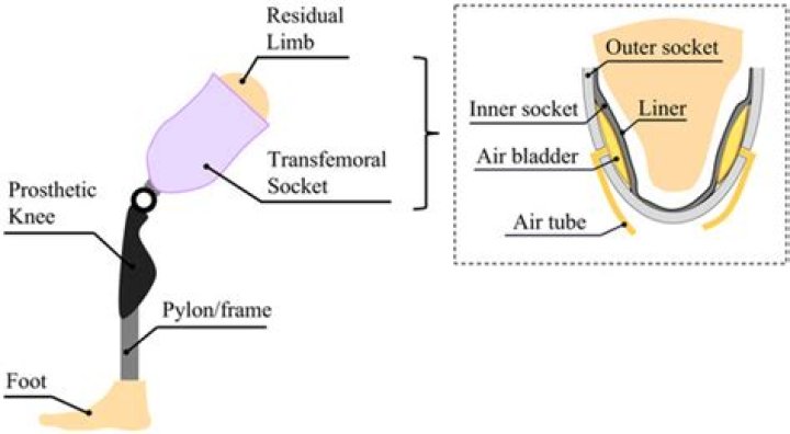 Thermal Management Device for Lower-Limb Prosthesis: PDF Guide