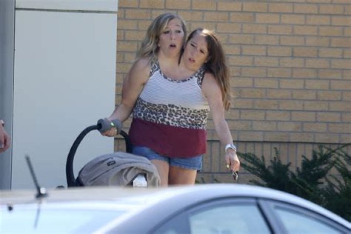 Abby and brittany hensel conjoined twins where are they now rewaevo