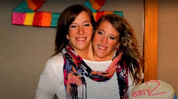 Abby and Brittany Hensel &mdash; See What the Famous Conjoined Twins Look