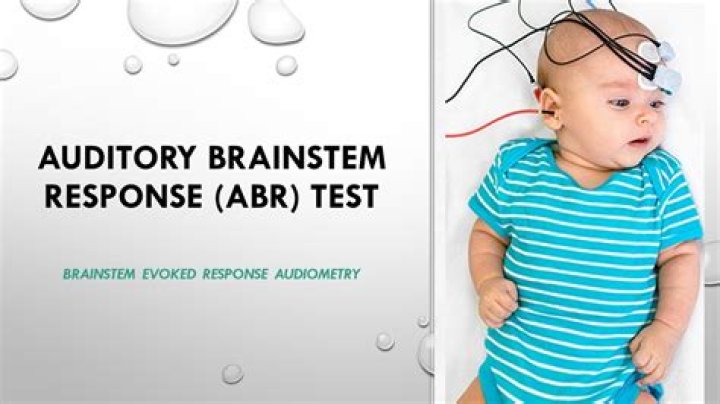 Ablb Test PDF: How to Download, Interpret, and Prepare for Your Ablb Assessment