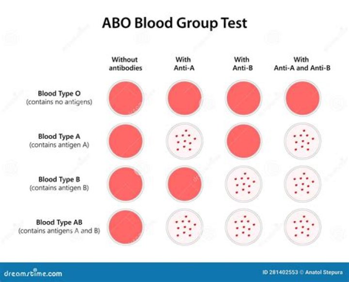ABO Blood Group Test PDF: Accurate & Reliable Home Testing