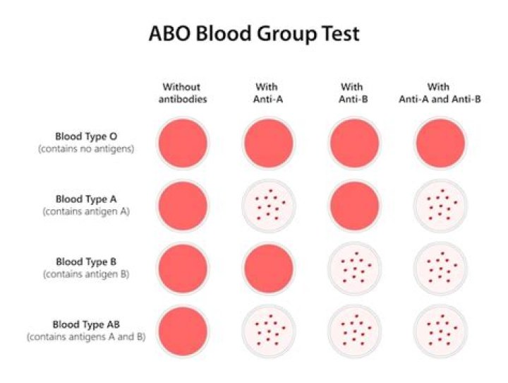 ABO Blood Grouping Test PDF: Accurate Diagnosis for Blood Type Identification