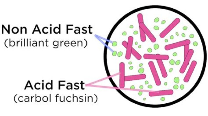 Acid Fast Bacilli Test PDF: Accurate Diagnosis Guide