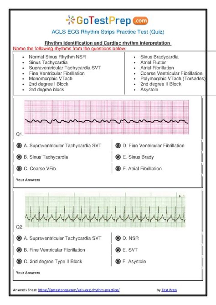 ACLS Rhythm Strips Answers PDF Free Download – Instant Guide