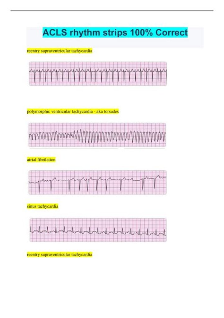 Acls Rhythm Strips Answers PDF – Expert Step-by-Step Guide
