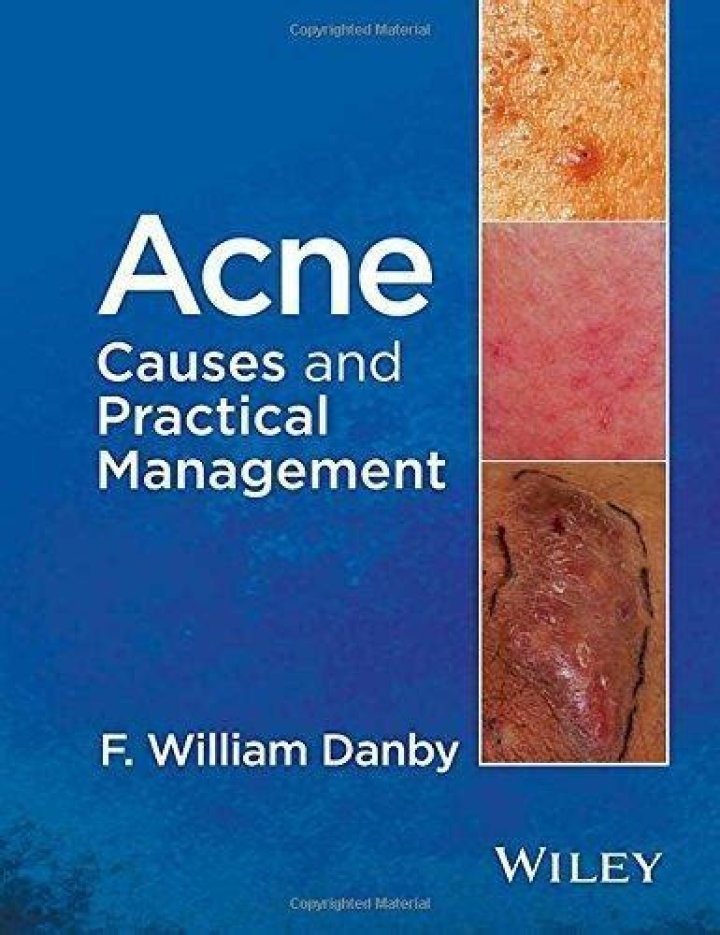 Acne Causes and Practical Management: PDF Guide for Clear Skin