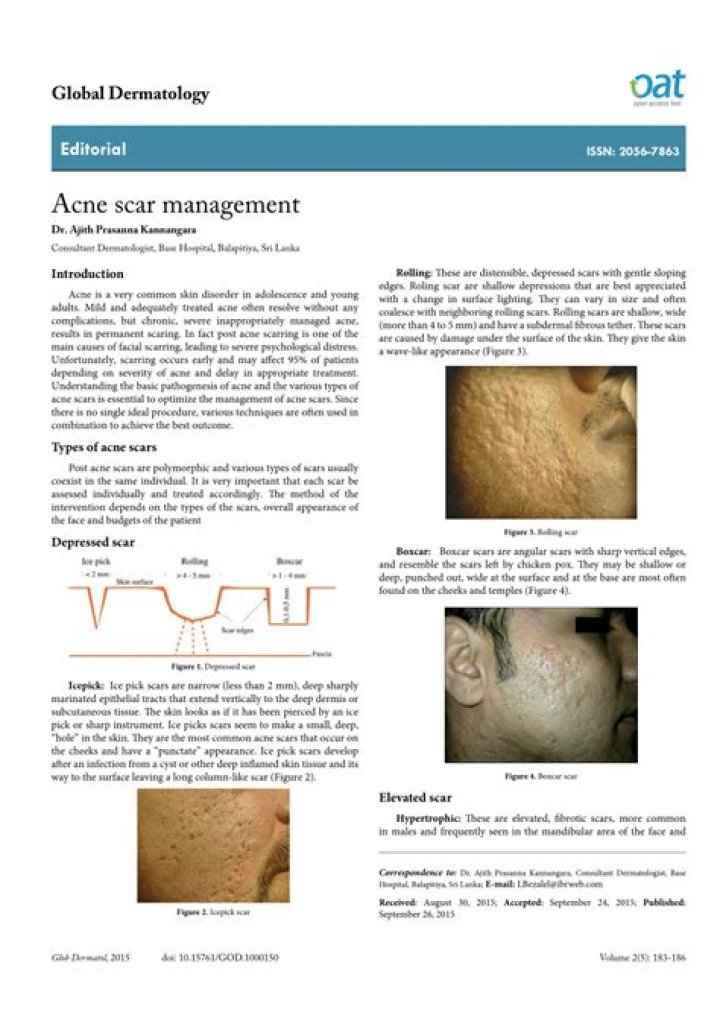 Effective Acne Scar Management PDF: Clear Skin & Reduce Scars Fast