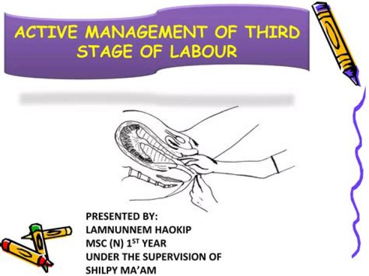 Active Management of Third Stage of Labor: Essential PDF Guide