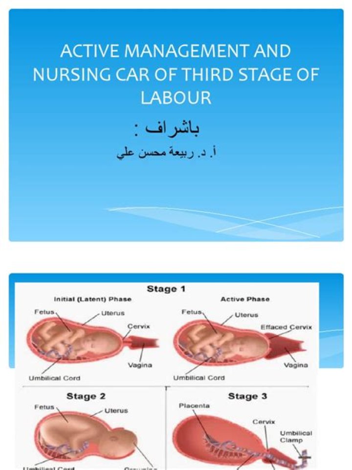Active Management of Third Stage of Labour: Essential PDF Guide