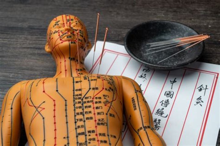 Acupuncture Risk Management PDF: Essential Safety Guidelines