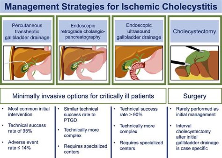 Acute Cholecystitis Management PDF: Essential Treatment Guidelines