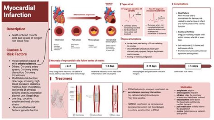 Acute Myocardial Infarction Management: Essential PDF Guide