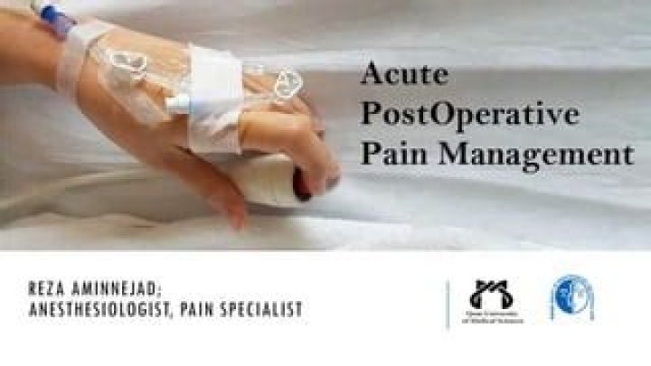 Acute Postoperative Pain Management: Essential PDF Guide
