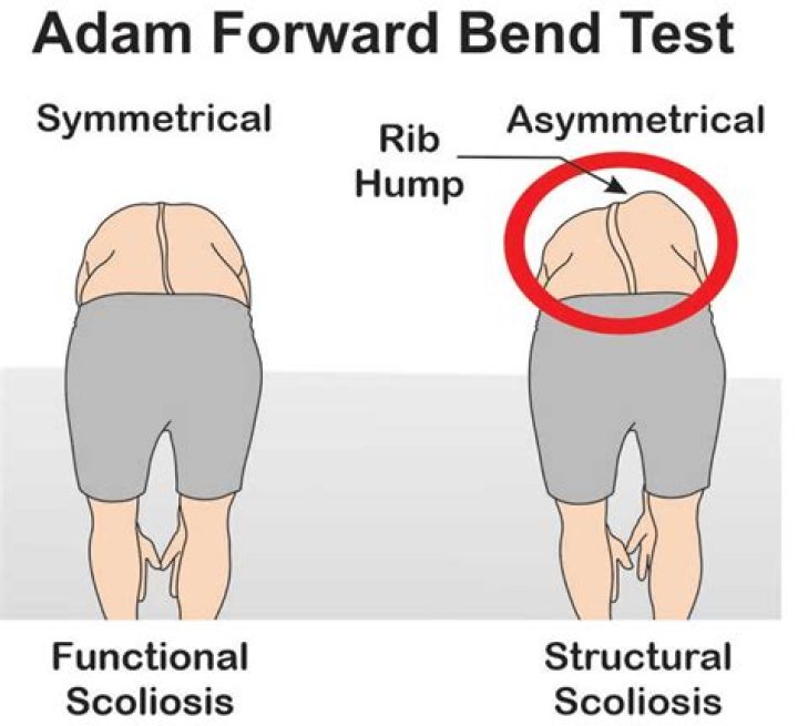 Adams Forward Bending Test PDF: Guide & PDF Download