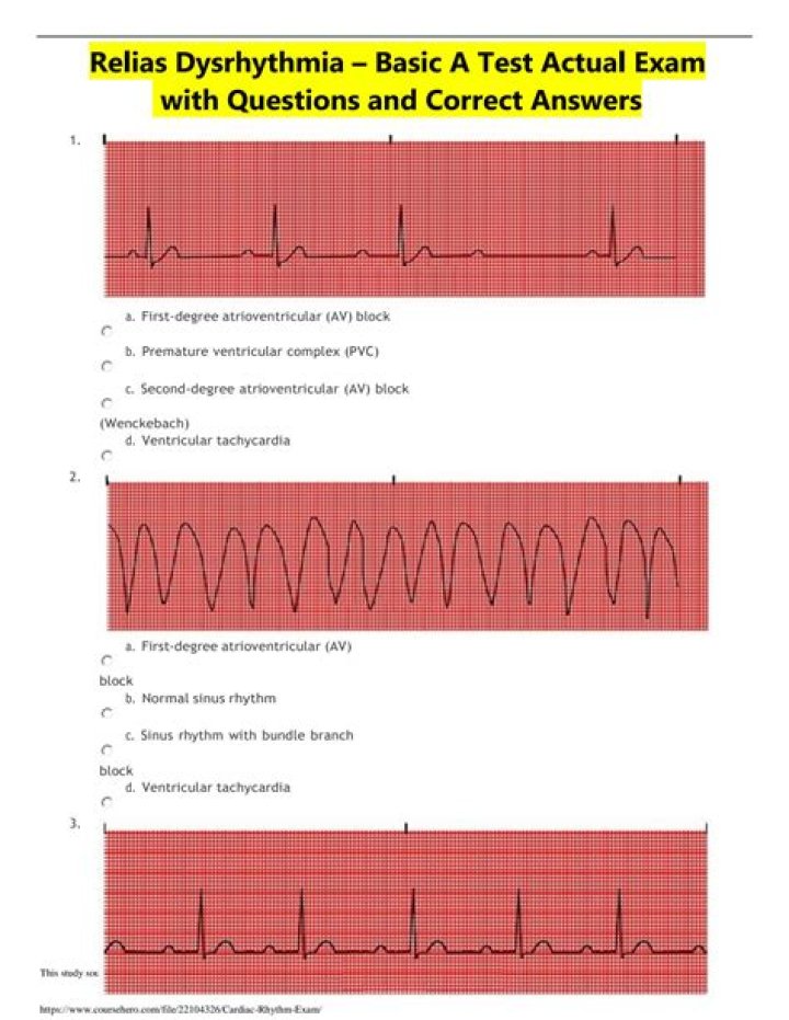 Advanced Dysrhythmia Assessment & Relias Answers PDF: Expert Insights