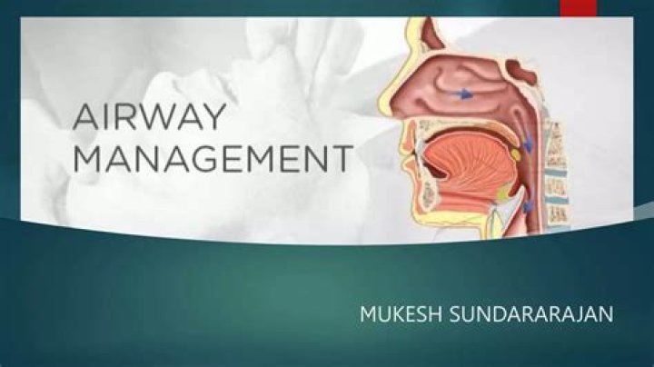 Airway Assessment and Management PDF: Essential Clinical Guide