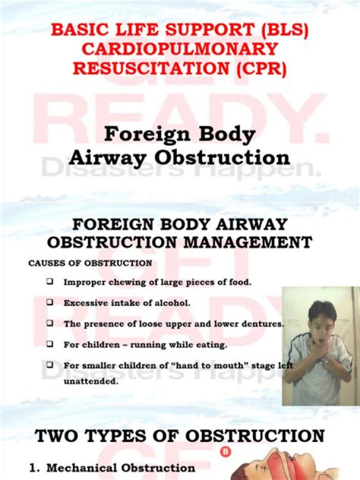 Airway Obstruction Management: Expert PDF Guide