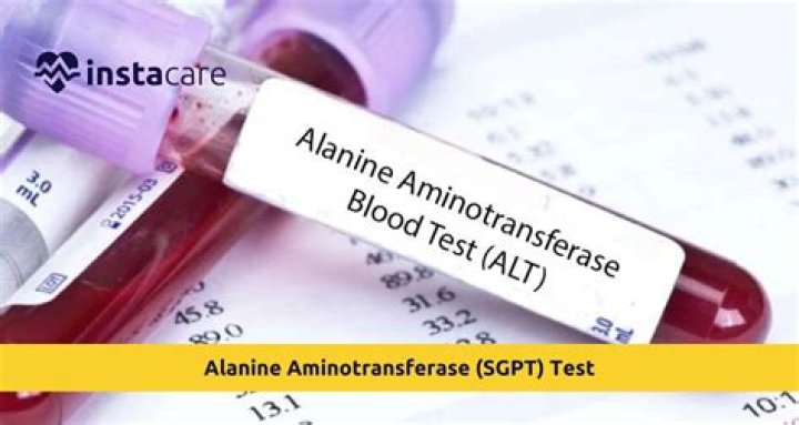 Alanine Aminotransferase Test PDF: Essential Guide & Results Interpretation