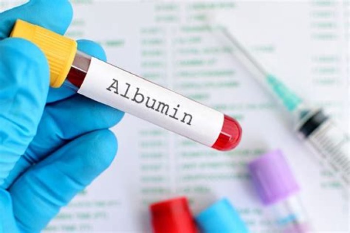 Albumin Test Procedure: Step-by-Step Guide & PDF Reference