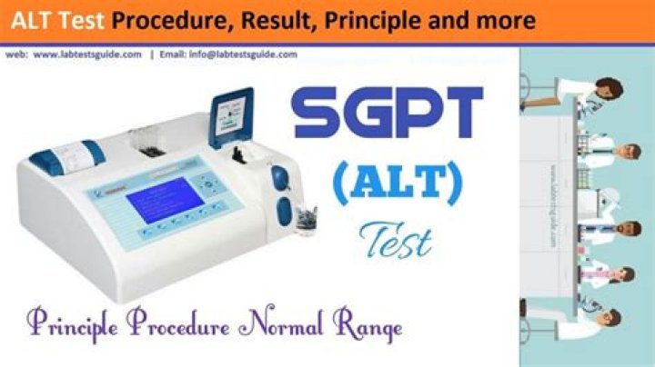 ALT Test Procedure PDF: Step-by-Step Guide for Accurate Results