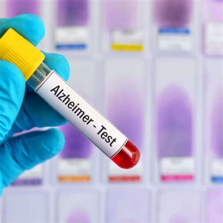 Alzheimer's Quick Test PDF: Fast Screening & Early Detection Guide