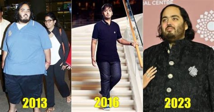 Anant Ambani Regains Weight After Losing 108 Kgs, Doctor Explains The
