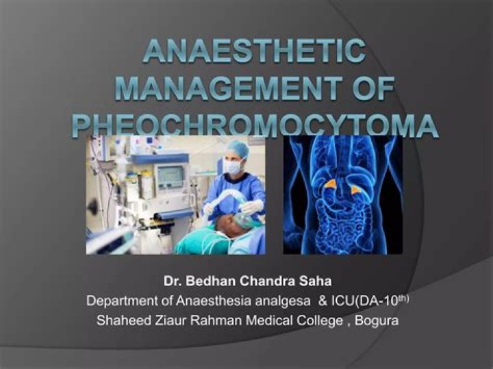 Anesthetic Management of Pheochromocytoma: Essential PDF Guidelines