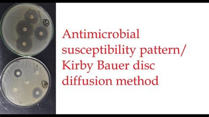 Antibiogram Test PDF: Essential Guide & Download