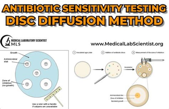 Antibiotic Sensitivity Test in Microbiology: Essential PDF Guide