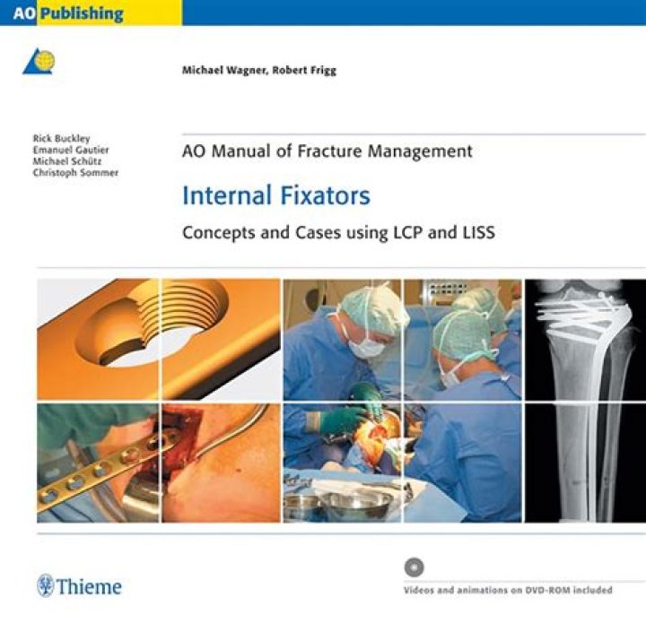 AO Manual of Fracture Management with Internal Fixators: Comprehensive PDF Guide