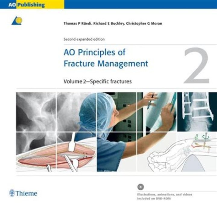 Ao Principles of Fracture Management: Essential PDF Guide