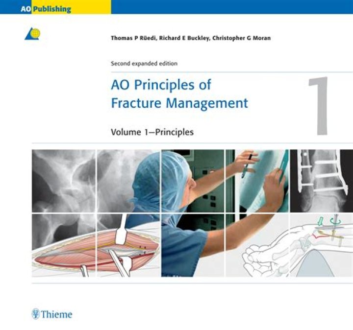 Ao Principles of Fracture Management: Essential PDF Guide