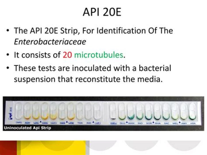 API Test Microbiology PDF: Accurate Lab Results with Efficient Testing