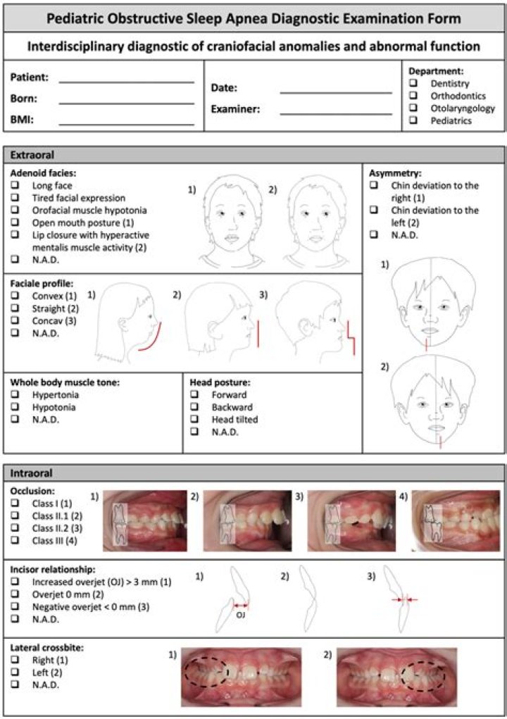 Apnea Test Protocol PDF: Essential Guidelines for Accurate Diagnosis