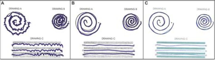 Archimedes Spiral Test PDF: Analysis & Download