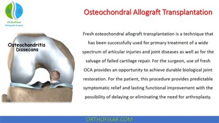 Arthroscopic Management of Osteochondral Defects of the Hip: Expert PDF Guide
