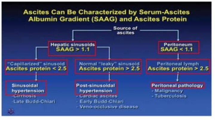 Ascites Diagnosis and Management: Essential PDF Guide