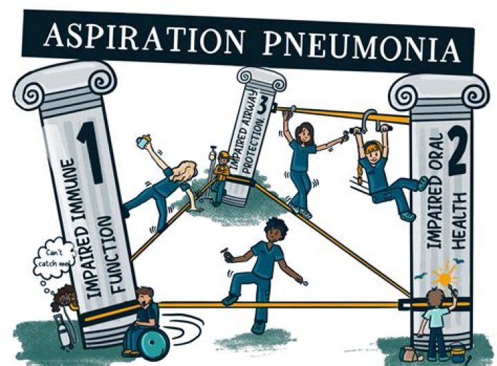 Comprehensive Aspiration Pneumonia Management PDF Guide