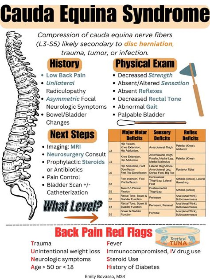 Comprehensive Assessment and Management of Cauda Equina Syndrome PDF Guide