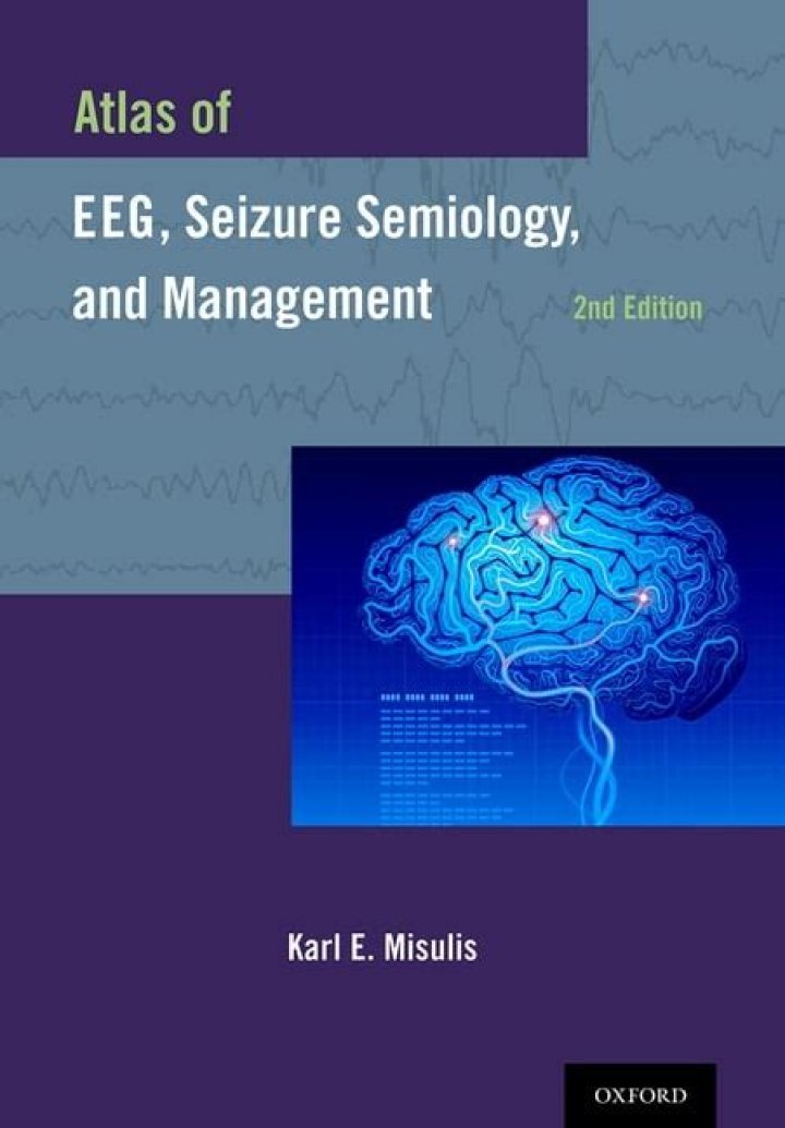 Atlas of EEG Seizure Semiology and Management – Free PDF Download