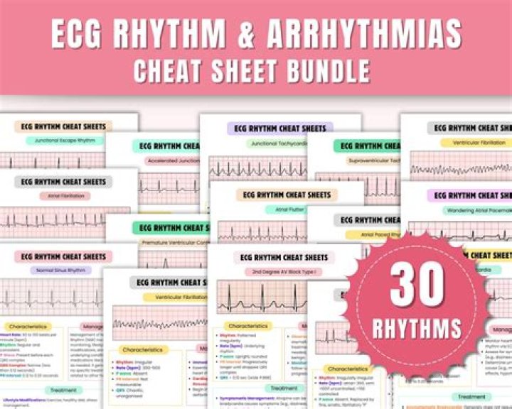 Basic Arrhythmia Test Answers PDF: Quick Guide to Understanding Heart Rhythms