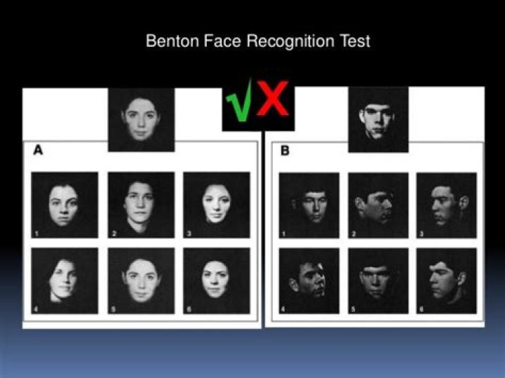 Benton Facial Recognition Test PDF: Accurate Online Assessment