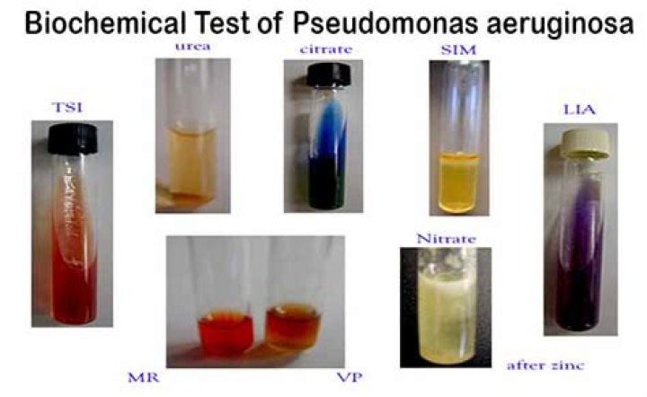 Biochemical Test for Pseudomonas Aeruginosa: Essential PDF Guidelines