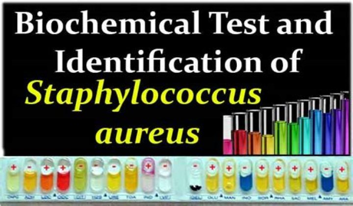 Biochemical Test for Staphylococcus Aureus: Essential PDF Guide