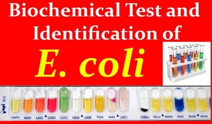 Biochemical Tests for Identifying E. coli: Essential Lab Protocols PDF