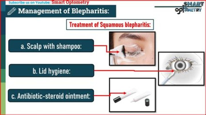Effective Blepharitis Management: Free PDF Guide